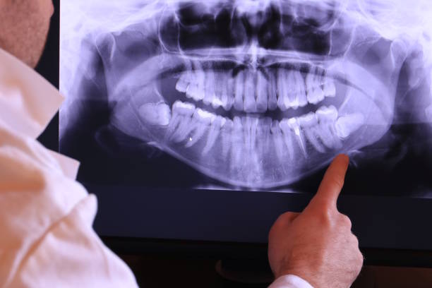 Best Emergency Tooth Extraction in White Settlement, TX